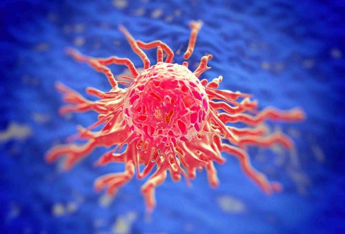 Քաղցկեղը բուժվում է, բայց ոչ սոդայով