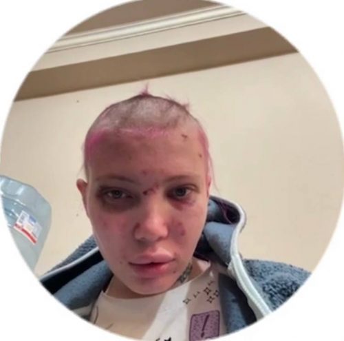 Задержанная россиянка пыталась убежать через окно туалета, но упала и получила травмы