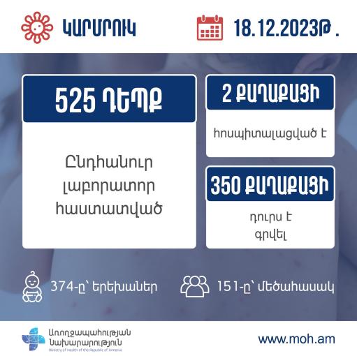 Laboratory-confirmed cases of measles in Armenia reach 525 - ABCMEDIA