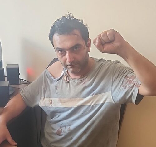 Abraham Gasparyan taken to police department in blood, with clothes torn and no shoes