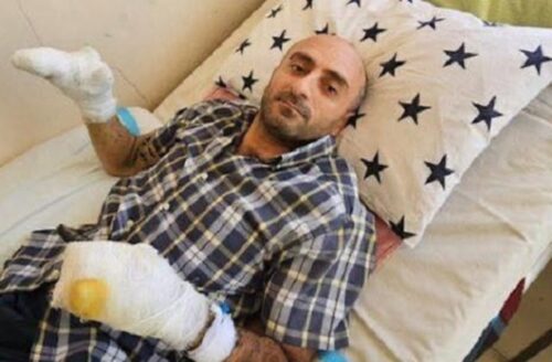 Լուսաձայնային նռնակից վիրավորված քաղաքացու ցուցամատը այսօր ամպուտացրել են, կրծքավանդակից բեկոր հանել․ կինը մանրամասներ է հայտնել