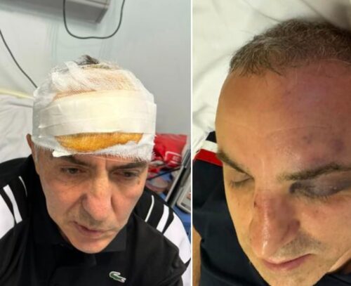 Граждан Арцаха жестоко избили бейсбольными битами за то, что они якобы не уступили дорогу: сигнал тревоги