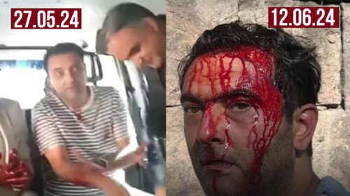 ՊԱՐԶԱԲԱՆՈՒՄ․ Աբրահամ Գասպարյանի՝ տարածվող լուսանկարների վերաբերյալ