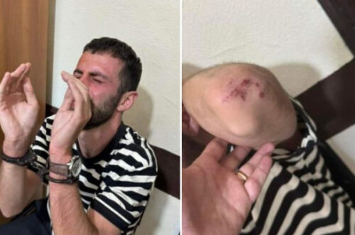 Назначено служебное расследование по факту избиения Арама Ерицяна патрульными