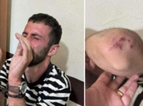 Պարեկների կողմից բռնության ենթարկված արցախցի Արամ Երիցյանի գործով տեղի է ունենում ամոթալի կեղծիք. Ռուբեն Մելիքյան