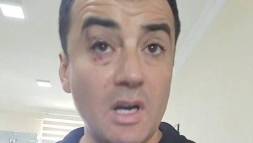 Артура Чахояна доставили в больницу из отделения полиции