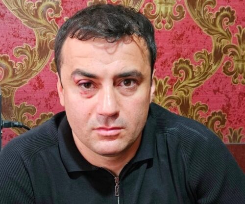 Артур Чахоян освобожден из-под незаконного ареста: адвокат