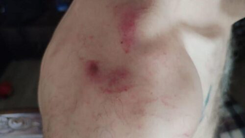 В полиции зафиксирован очередной случай насилия: адвокат бьет тревогу