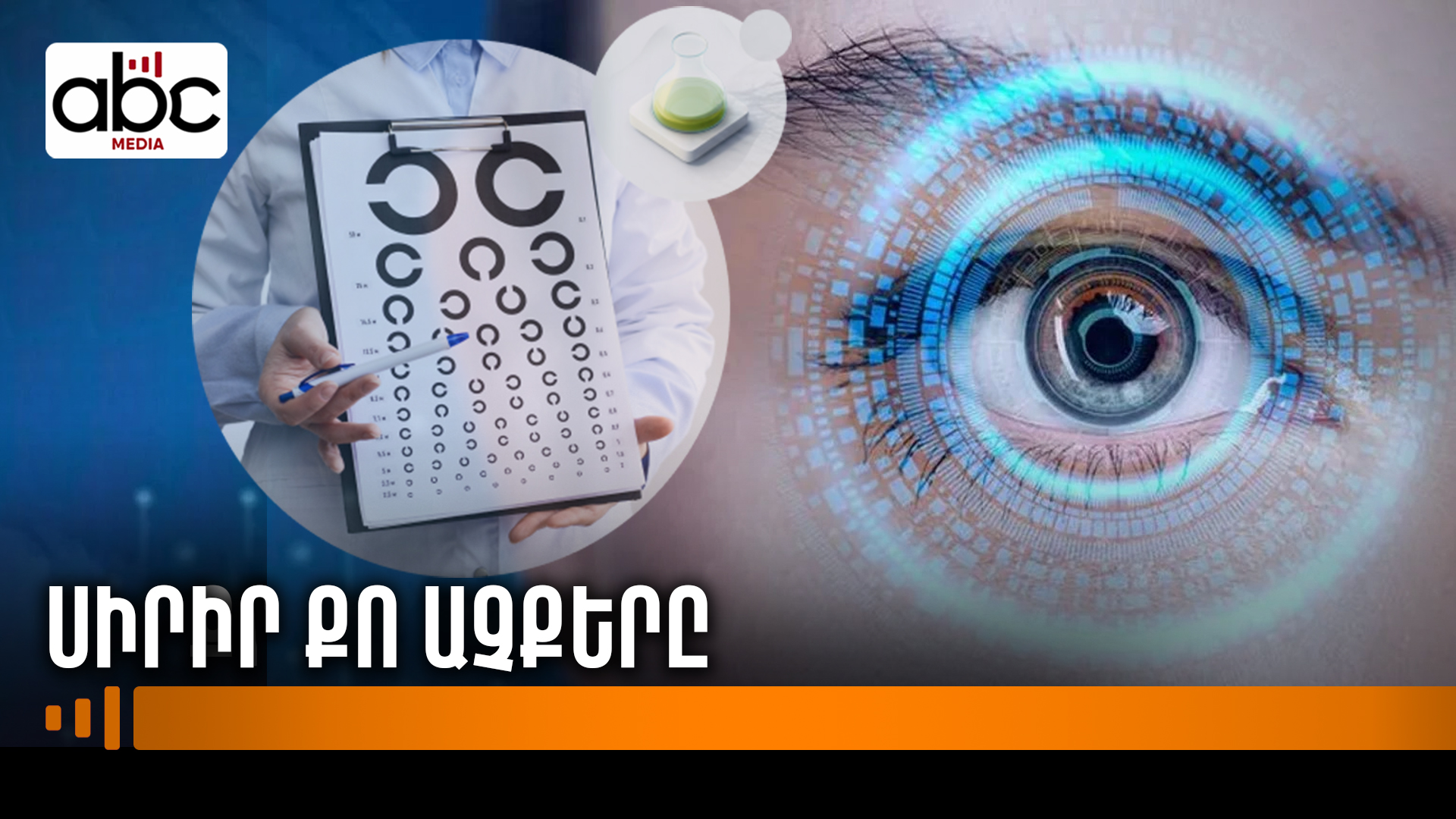 Աչքի անվճար ստուգում, խորհրդատվություն ու նվեր՝ ակնոց Աչքի անվճար ստուգում, խորհրդատվություն ու նվեր՝ ակնոց