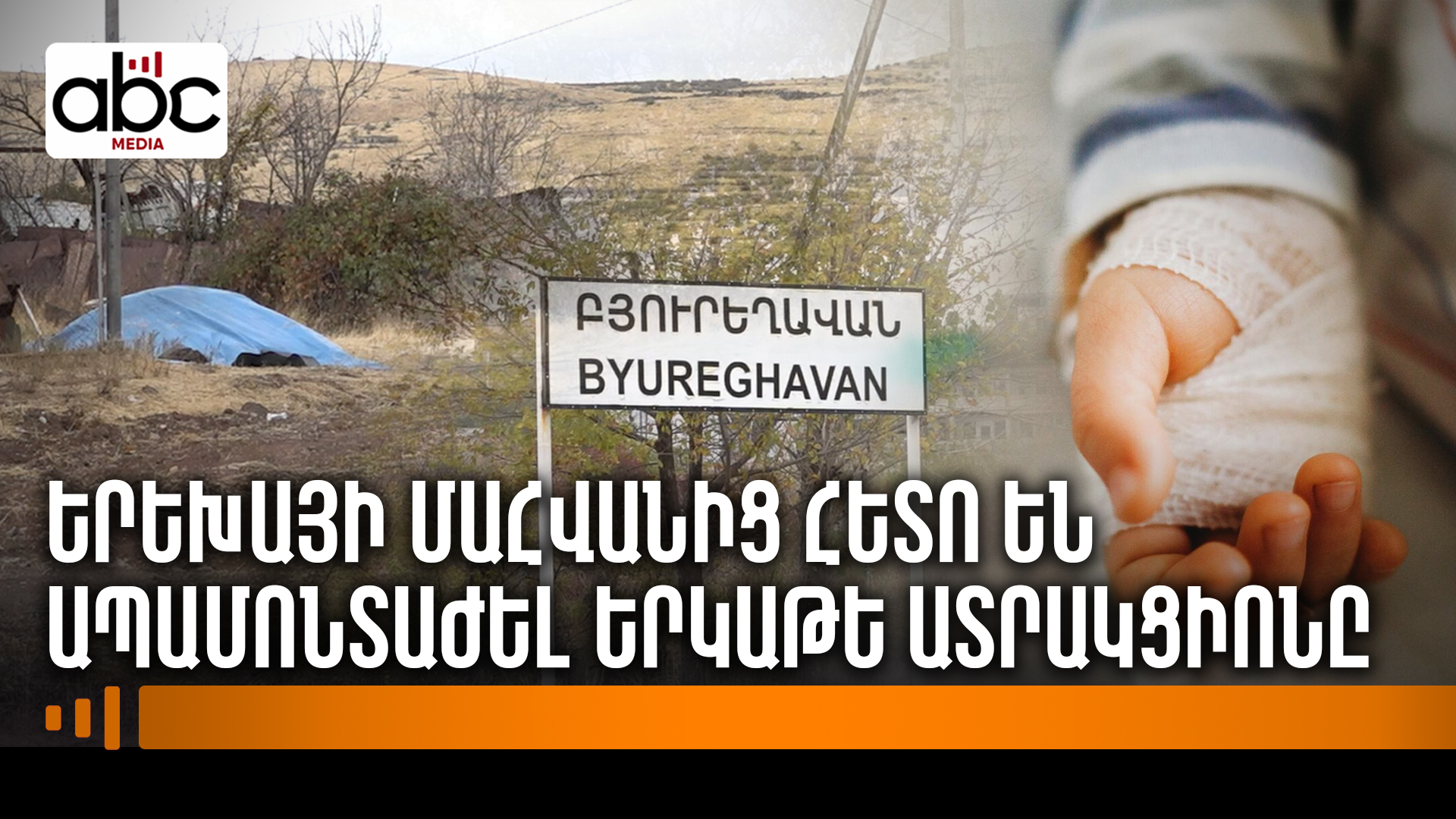 Կարուսելը պոկվել, ընկել է երեխայի վրա Կարուսելը պոկվել, ընկել է երեխայի վրա