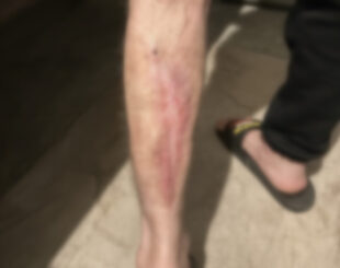 «Արմավիր» ՔԿՀ-ի բուժանձնակազմի համակարգային անգործությունը կյանքեր է վտանգում. հայտարարություն