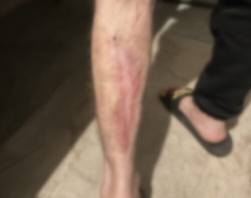 «Արմավիր» ՔԿՀ-ի բուժանձնակազմի համակարգային անգործությունը կյանքեր է վտանգում. հայտարարություն